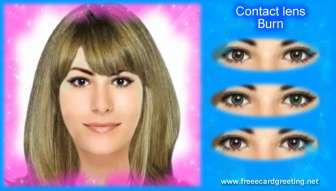 Color Contact lens Burn